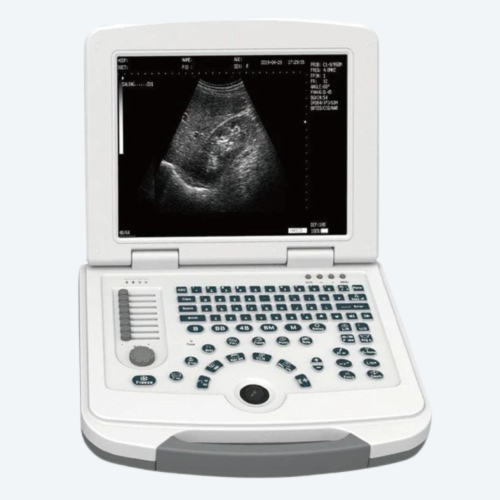 Portable Ultrasound System